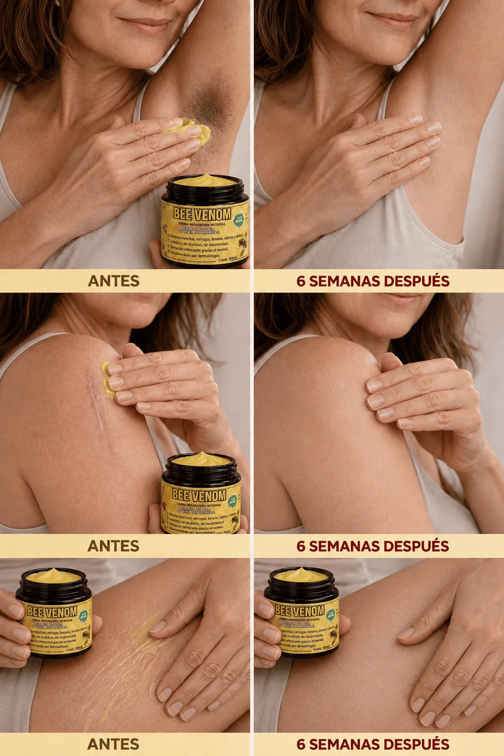 PAGA 1 LLEVA 2-BEE VENOM CREMA-ELIMINA TODOS LOS PROBLEMAS DE TU PIEL