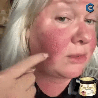 PAGA 1 LLEVA 2-BEE VENOM CREMA-ELIMINA TODOS LOS PROBLEMAS DE TU PIEL