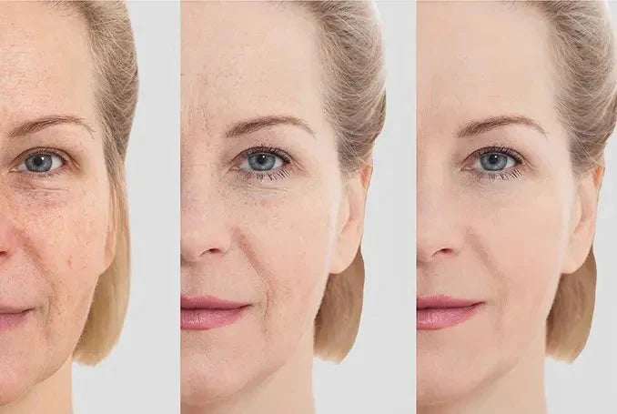 Masajeador Facial Reductor De Papada arrugas