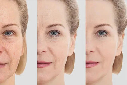 Masajeador Facial Reductor De Papada arrugas
