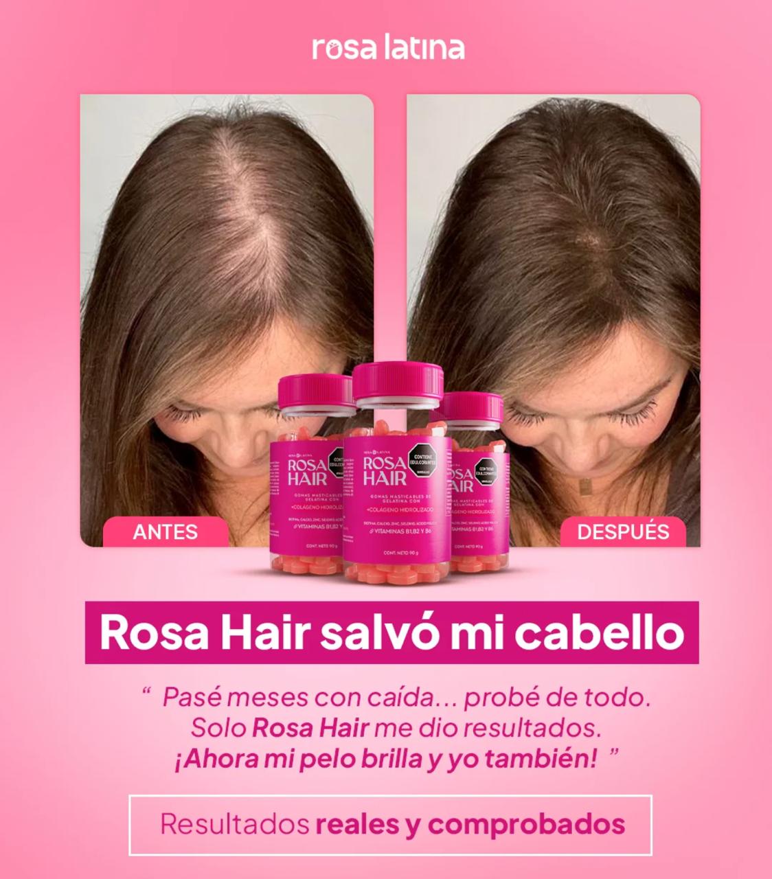 ROSA HAIR X3